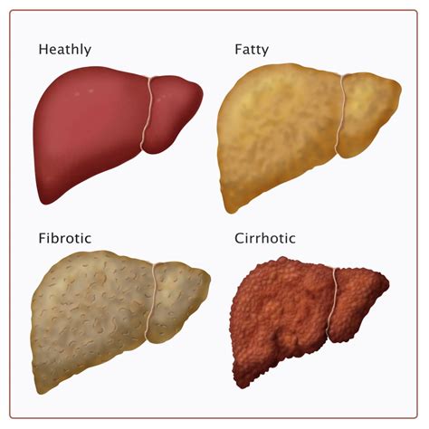 does berberine cause liver damage